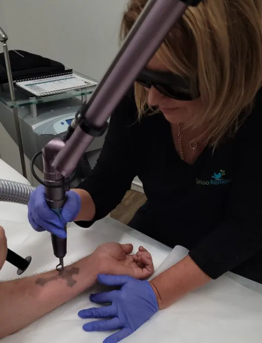 Tattoo Removals