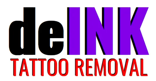 deINK Tattoo Removal