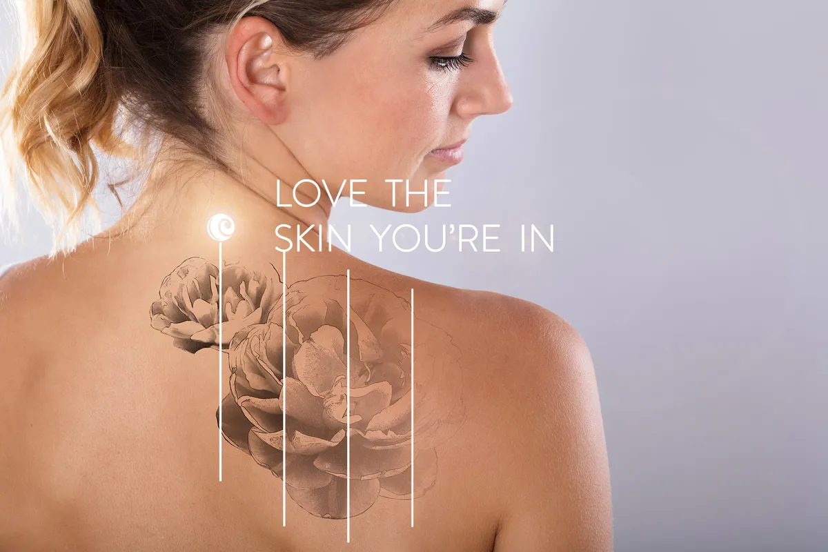 NZ Laser Tattoo Removal